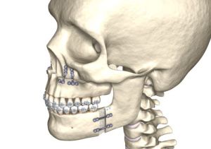 Skull